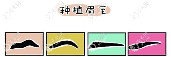 种植眉毛手术靠谱 59w.net