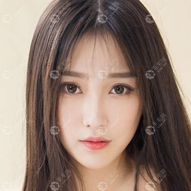 我做牙齿贴面5年后感受:龅牙做瓷贴面不如直接做牙齿矫正