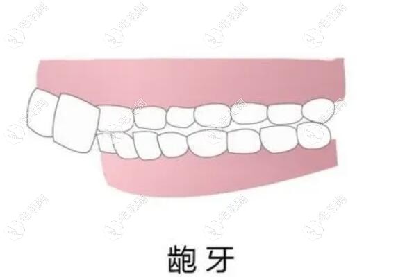 这是龅牙动画的展示图