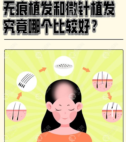 无痕种植0元问诊