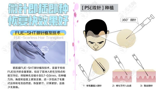 碧莲盛sht跟科发源pse的区别