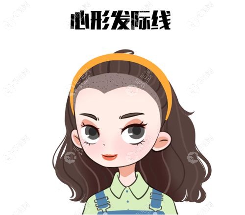 广州发际线种植不剃发医院推荐top10