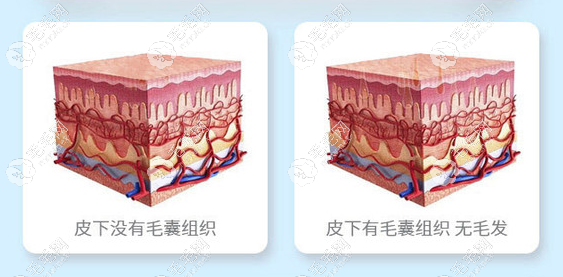 圣爱告诉大家并不是什么情况都可以考虑植发