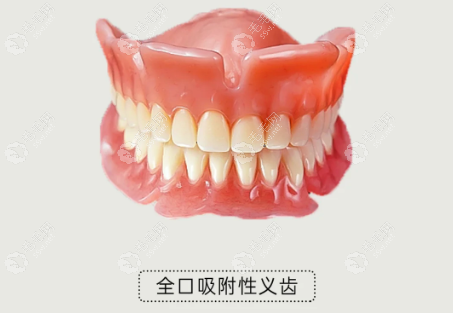 吸附性义齿