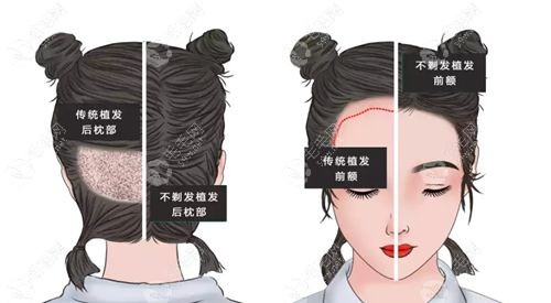 术后护理生死线