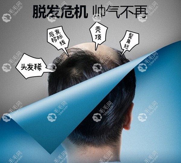 淮安正规植发医院