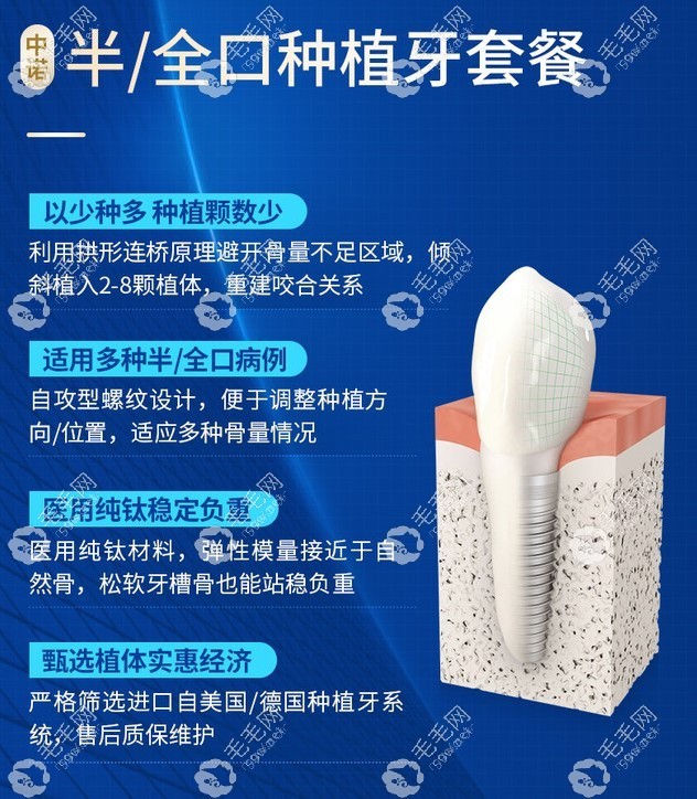 北京中諾口腔醫(yī)院半口/全口種植牙介紹