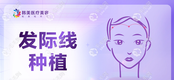 泸州韩美发际线种植价格