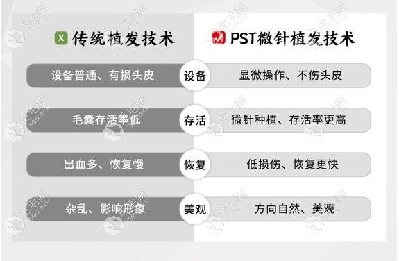 深圳鹏程医院微针植发技术怎么样？