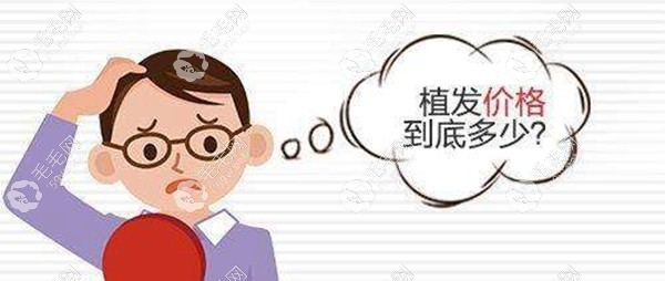 在杭州正规植发医院植2025根多少钱