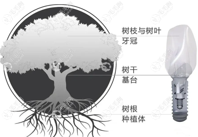 韩国种植体三大 品牌：登腾、奥齿泰、纽百特