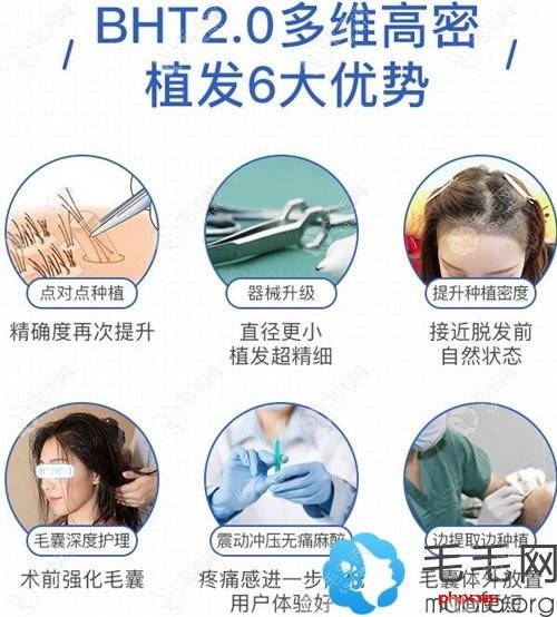 碧莲盛bht植发技术优势