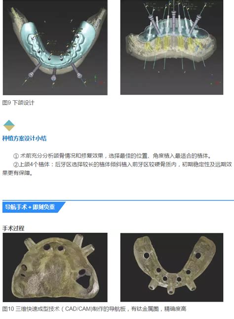 冠軍病例再次 … jykm88.com