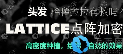 雍禾lattice点阵加密植发技术