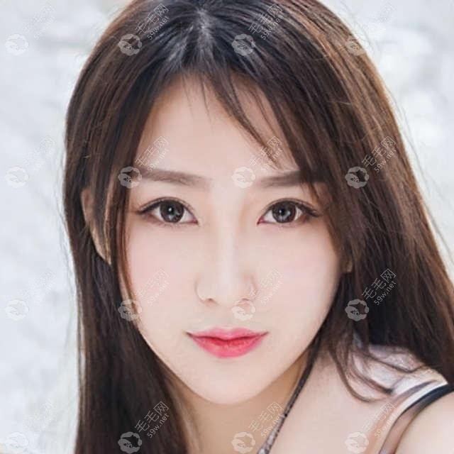 哈尔滨植发哪家好?献上哈尔滨正规植发医院排名附价格案例