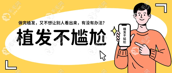 昆明不剃發(fā)植發(fā)的醫(yī)院有哪些www.053w.com