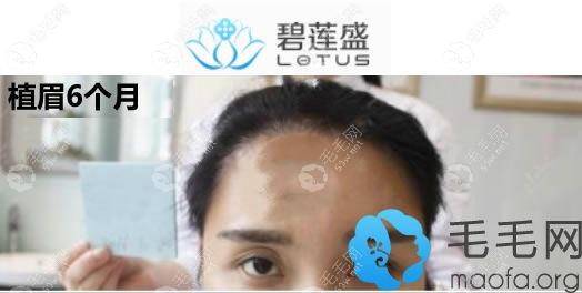在碧蓮盛種植眉毛6個月的效果非常自然