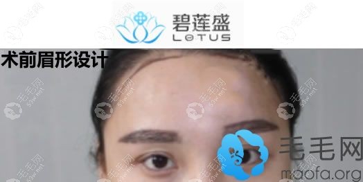 眉毛種植前的眉形設(shè)計(jì)圖