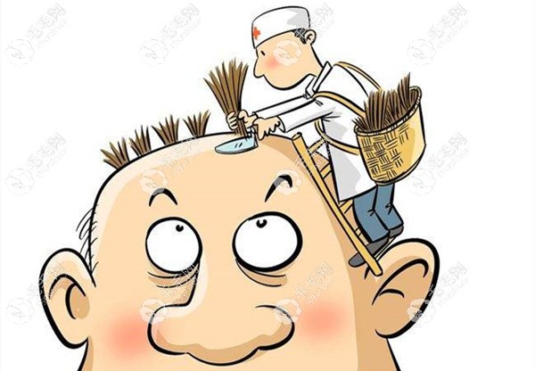 在青海想植发的发友，看看植发得多少钱？