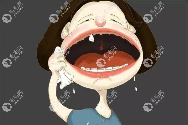 全口烤瓷牙一般需要多少钱