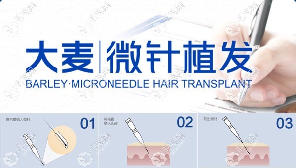 疤痕植发哪个医院好？疤痕植发品牌好的有大麦微针植发