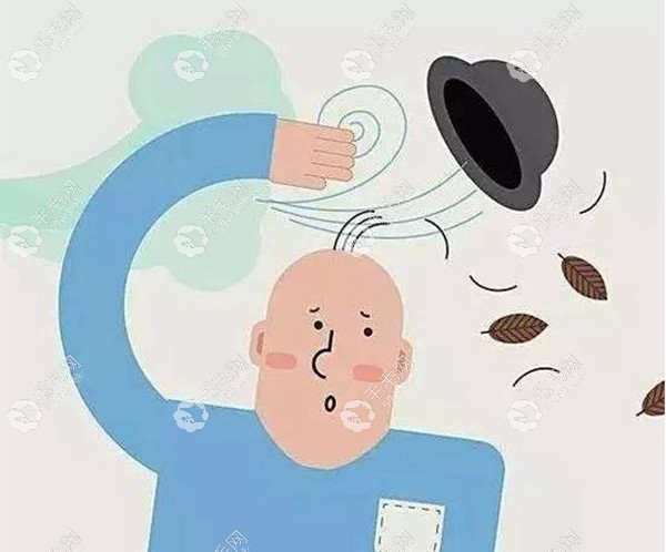在重慶已經(jīng)脫發(fā)的親們，可以做植發(fā)呦