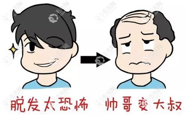 脱发对颜值有一定的影响