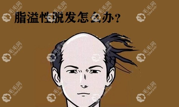 脂溢性皮炎导致的脱发咋办呢？