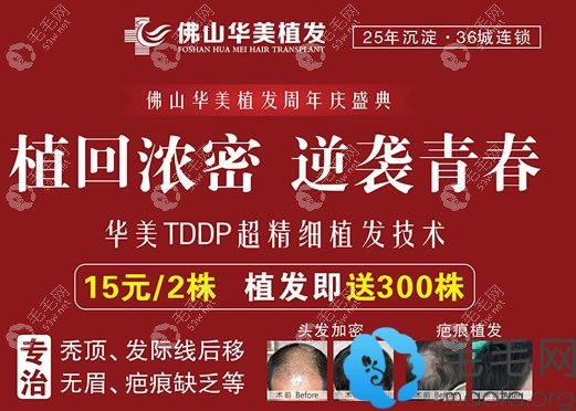 佛山华美医院植发价格表