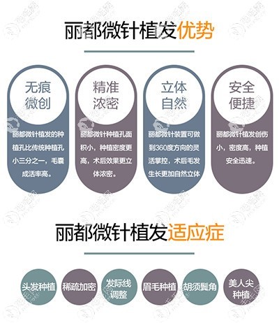 北京米兰柏羽丽都微针植发技术优势