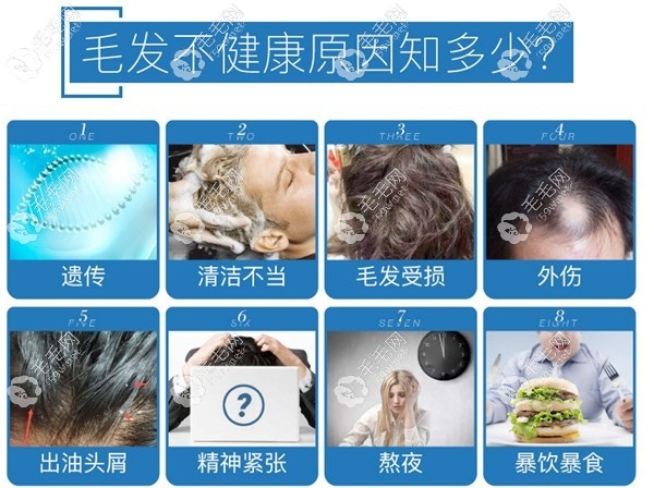 蘇州看脫發(fā)比較好的醫(yī)院
