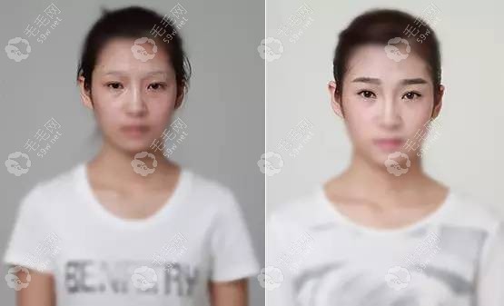 艺星毛发移植中心医生，王军旗。