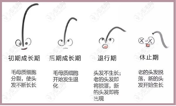 植发后脱落期可能会出现植发断层