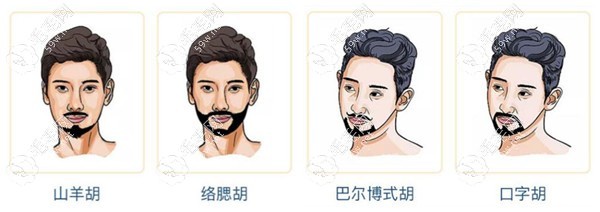 種植胡須親身經(jīng)歷分享來了