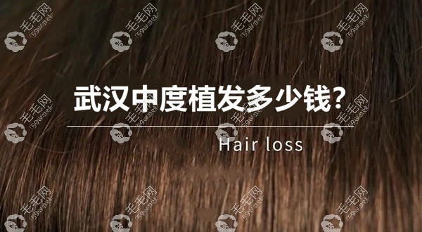 武漢中度植發(fā)多少錢？