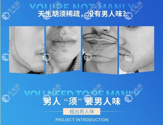 胡须种植比较好的医院有哪些
