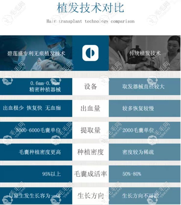 碧蓮盛SH植發(fā)技術(shù)的成功率