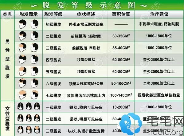 按脫發(fā)等級計(jì)算植發(fā)手術(shù)費(fèi)用