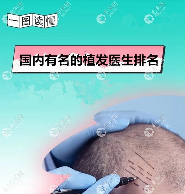 国内好的有名的植发医生排名