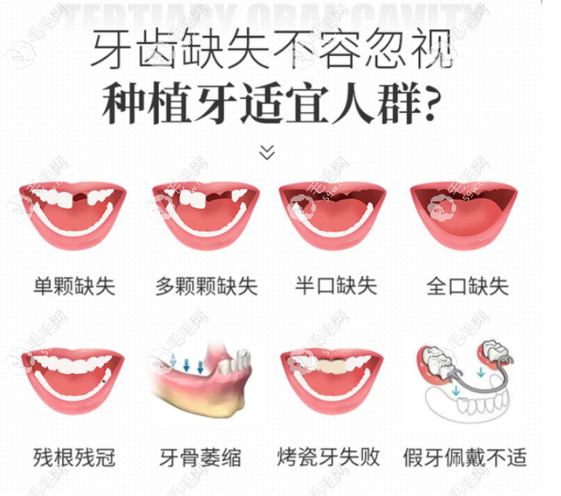 瑞士iti瑞鋯種植牙怎么樣