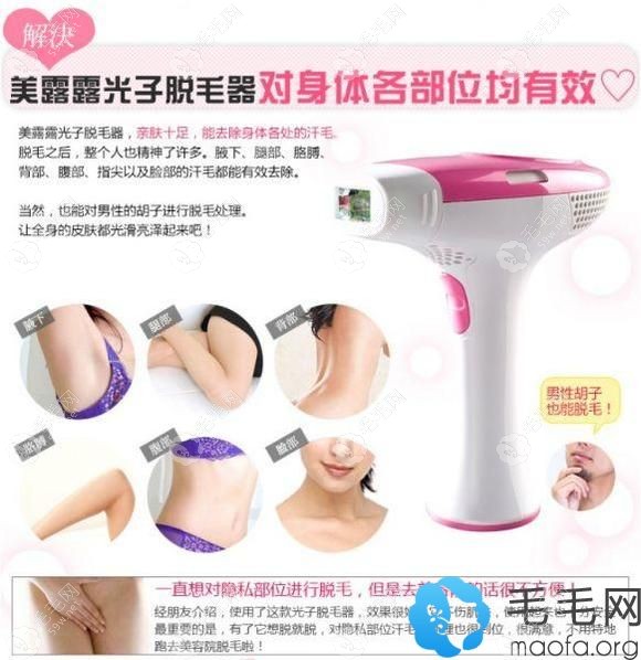 日本belulu家用IPL彩光脱毛机对身体各个部位适用