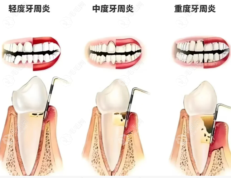 北大韦神抖音首秀:4秒视频暴露的不止流量,还有牙周炎之痛