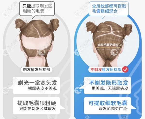 国内不剃发植发医院名单