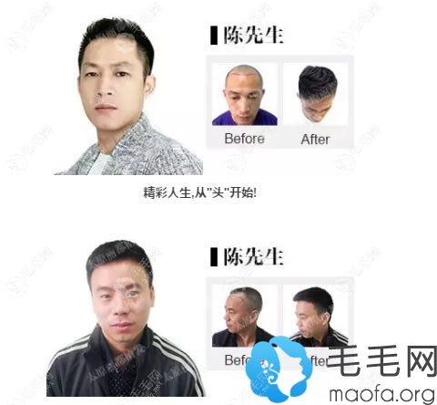 太原丽都朱世伟主任案例