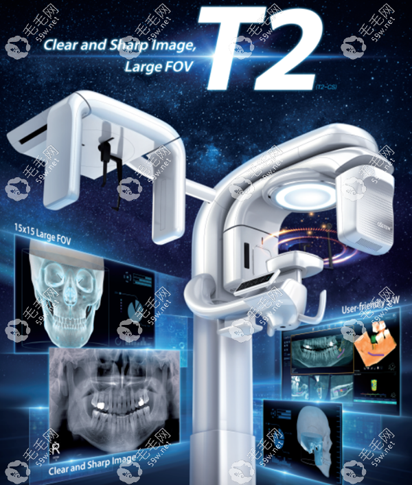 出種植牙專用CBCT"T2 設(shè)備