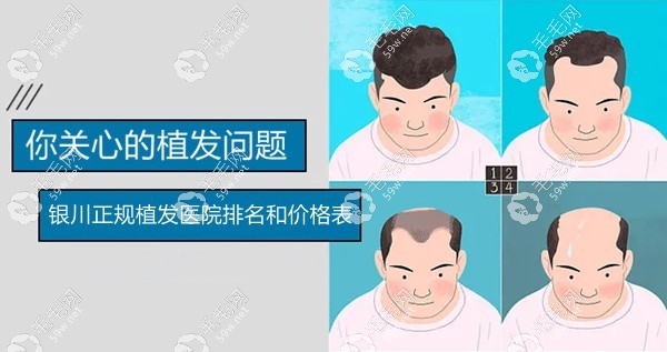 銀川正規(guī)植發(fā)醫(yī)院排名和價(jià)格表