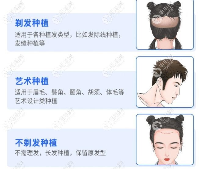 碧蓮盛毛囊煥活微針植發(fā)技術(shù)價(jià)格