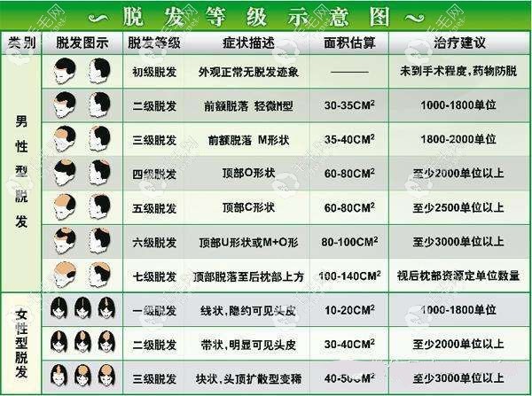 脱发等级真人对照图