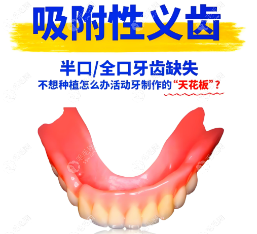 吸附性义齿
