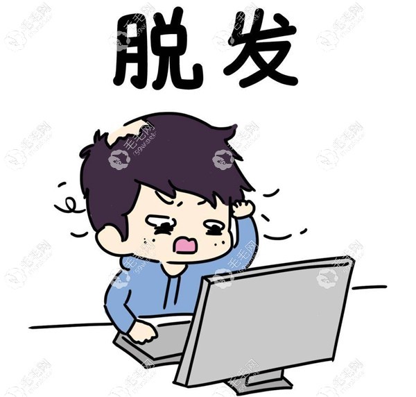 雄激素源性AGA脱发